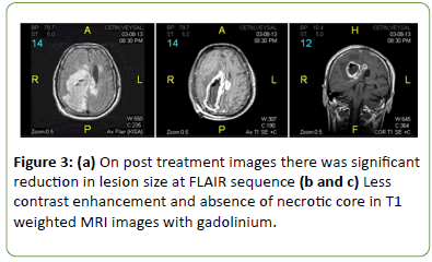 Neurology-Neuroscien-treatment-images
