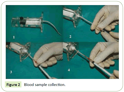 Neurology-Neuroscience-blood-sample