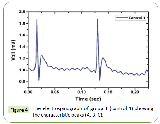 Neurology-Neuroscience-characteristic-peaks