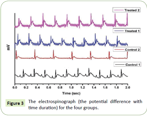 Neurology-Neuroscience-electrospinograph