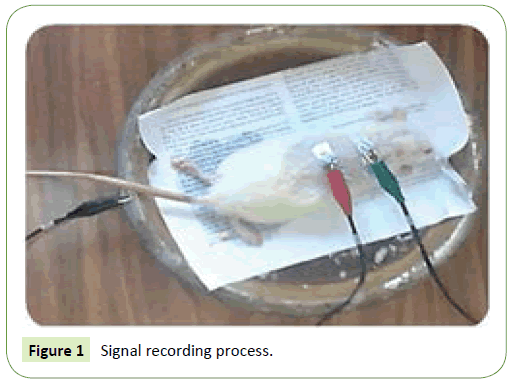 Neurology-Neuroscience-recording-process