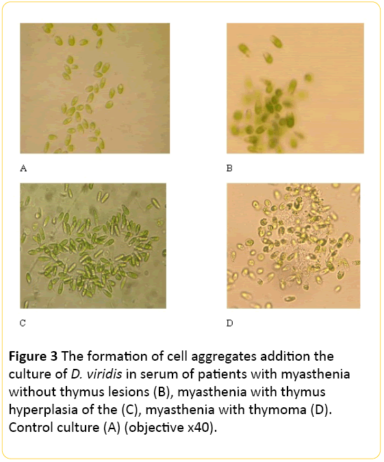 Translational-Biomedicine-cell-aggregates-myasthenia