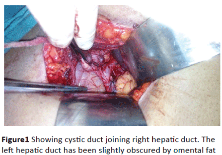 Translational-Biomedicine-hepatic-duct