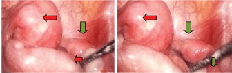 Universal-Surgery