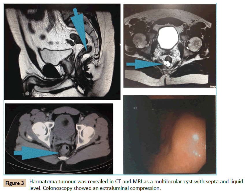 Universal-Surgery-CT-MRI-multilocular