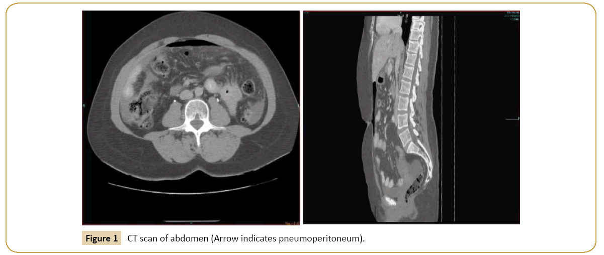 Universal-Surgery-CT-scan-abdomen