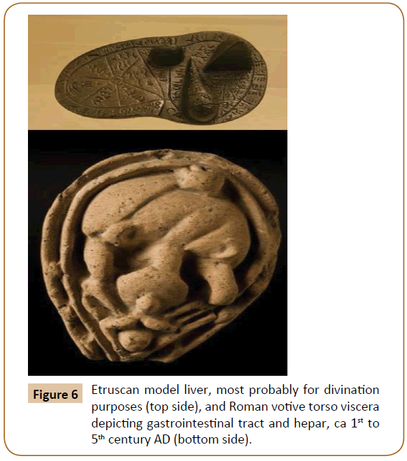 Universal-Surgery-Etruscan-model-liver