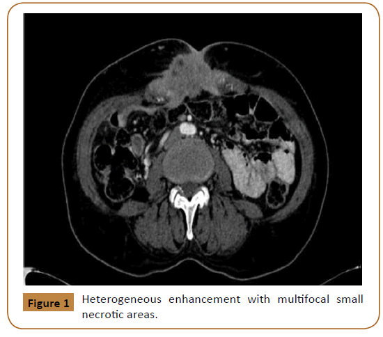 Universal-Surgery-Heterogeneous