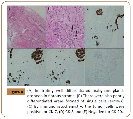 Universal-Surgery-Infiltrating