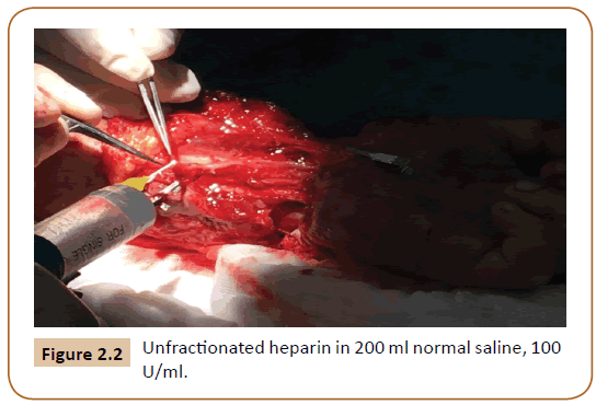 Universal-Surgery-Unfractionated