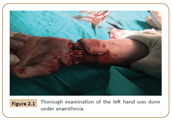 Universal-Surgery-anaesthesia