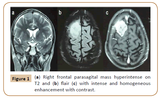 Universal-Surgery-frontal-parasagital