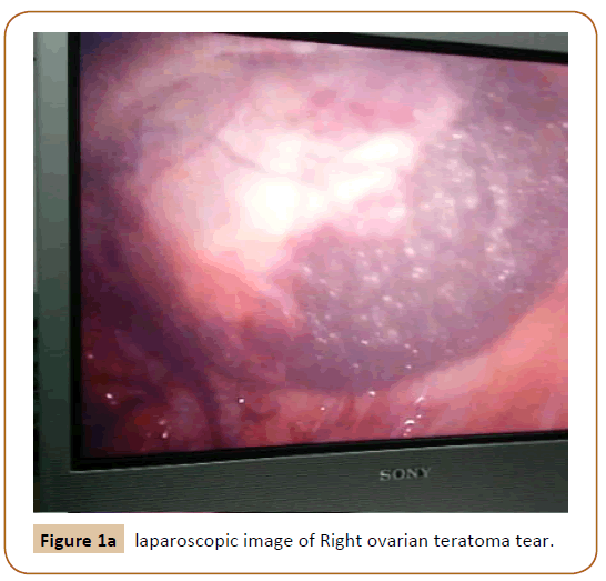 Universal-Surgery-laparoscopic