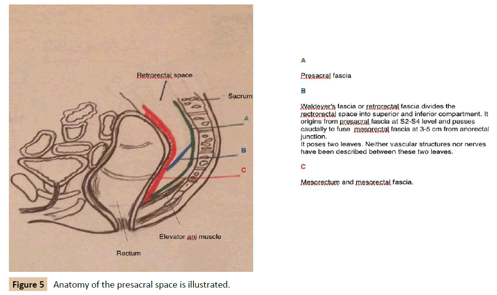 Universal-Surgery-presacral-space-illustrated