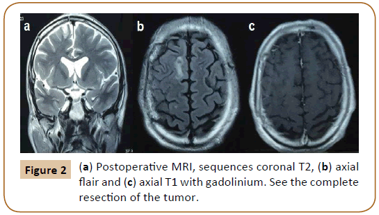 Universal-Surgery-sequences-coronal