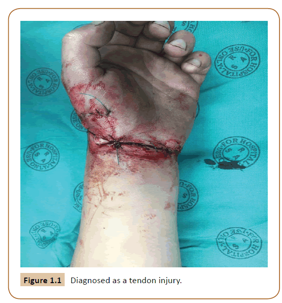 Universal-Surgery-tendon-injury