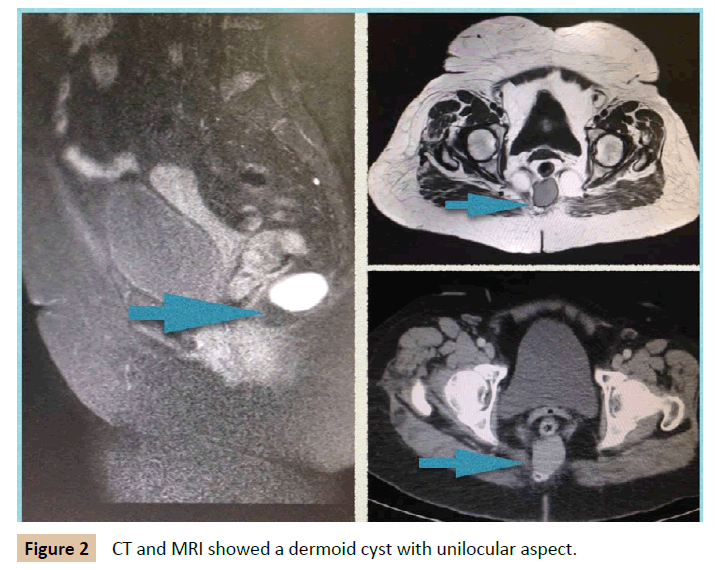 Universal-Surgery-unilocular-aspect