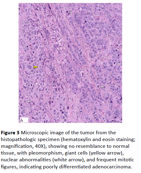 acanceresearch-Microscopic-histopathologic-specimen