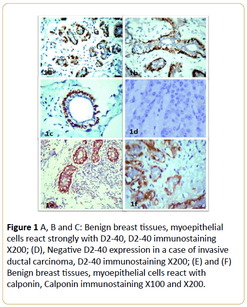 acanceresearch-breast-tissues-myoepithelial