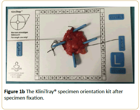 acanceresearch-kit-after-specimen-fixation