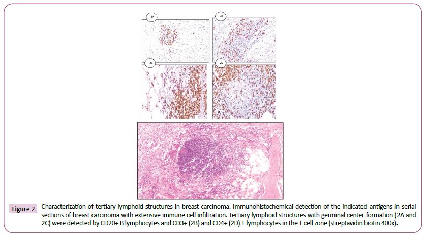 acanceresearch-lymphoid