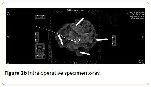 acanceresearch-operative-specimen