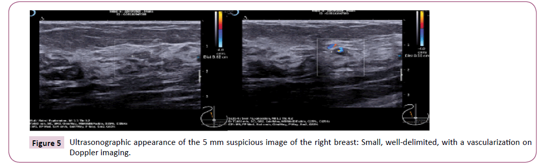 acanceresearch-ultrasonographic