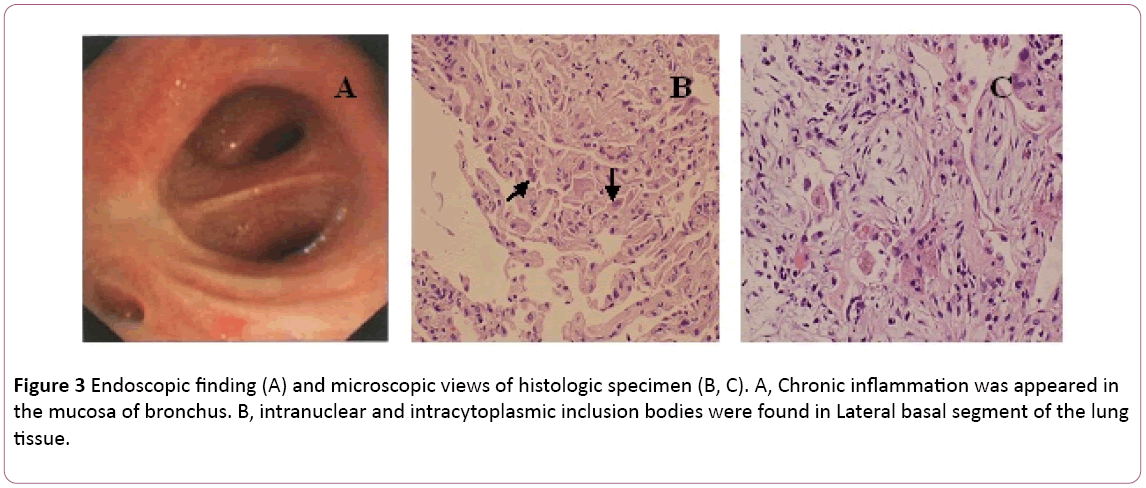 aclr-microscopic-views-histologic-specimen