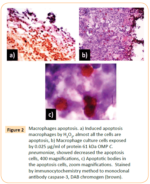 acmicrob-Macrophages-apoptosis