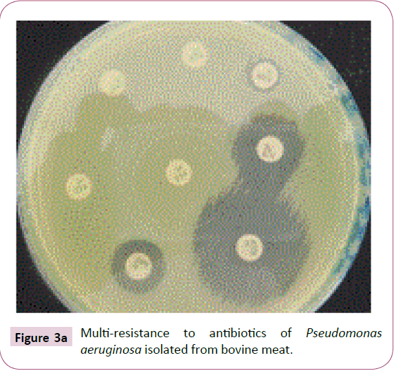 acmicrob-Multi-resistance