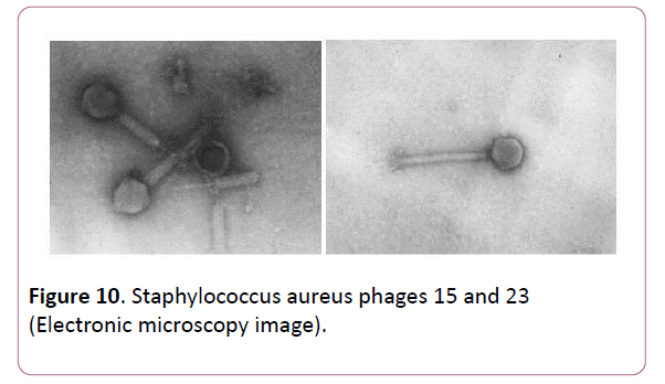 acmicrob-aureus-phages