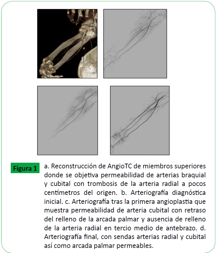 advanced-techniques-miembros-superiores