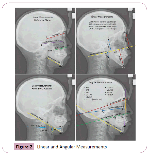 annals-clinical-Angular-Measurements