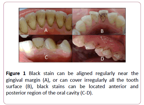 annals-clinical-laboratory-Black-stain