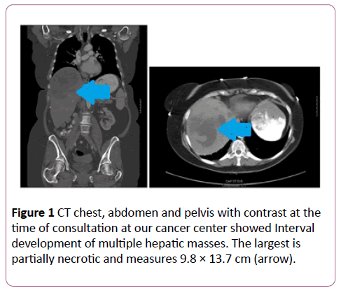 annals-clinical-laboratory-CT-chest