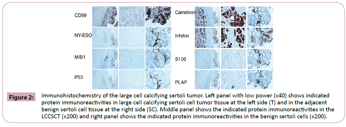 annals-clinical-laboratory-Immunohistochemistry