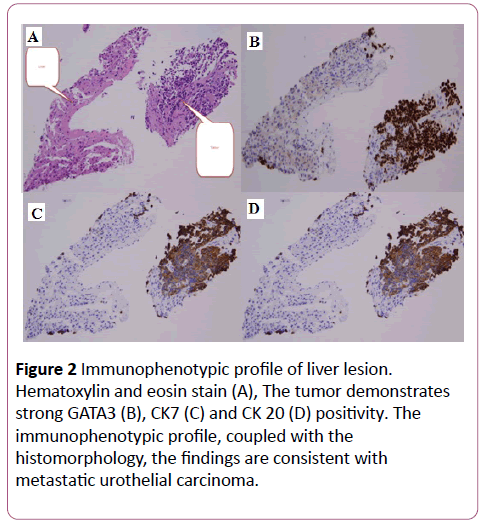 annals-clinical-laboratory-Immunophenotypic-profile