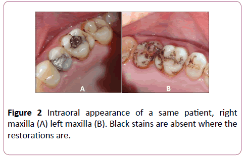 annals-clinical-laboratory-Intraoral-appearance