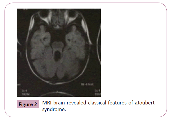 annals-clinical-laboratory-MRI-brain