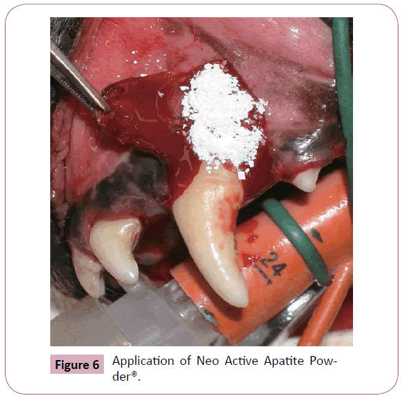 annals-clinical-laboratory-Neo-Active-Apatite
