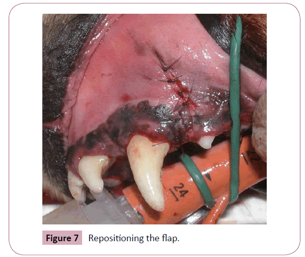 7annals-clinical-laboratory-Repositioning-flap