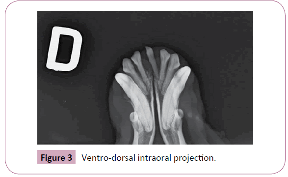 annals-clinical-laboratory-Ventro-dorsal