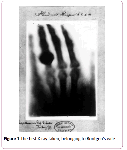 annals-clinical-laboratory-X-ray