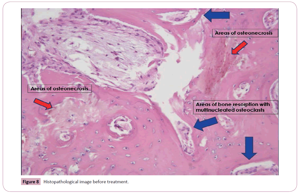 annals-clinical-laboratory-before-treatment