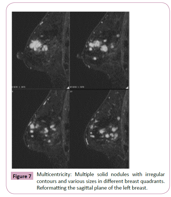 annals-clinical-laboratory-breast-quadrants