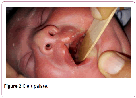 annals-clinical-laboratory-cleft