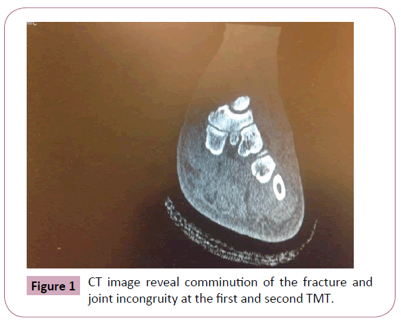 annals-clinical-laboratory-joint-incongruity