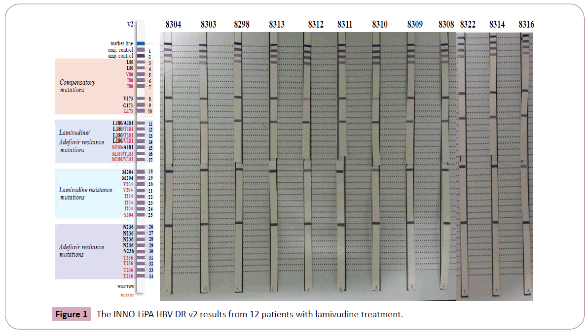 annals-clinical-laboratory-lamivudine-treatment