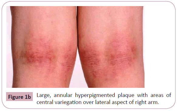 annals-clinical-laboratory-lateral-aspect