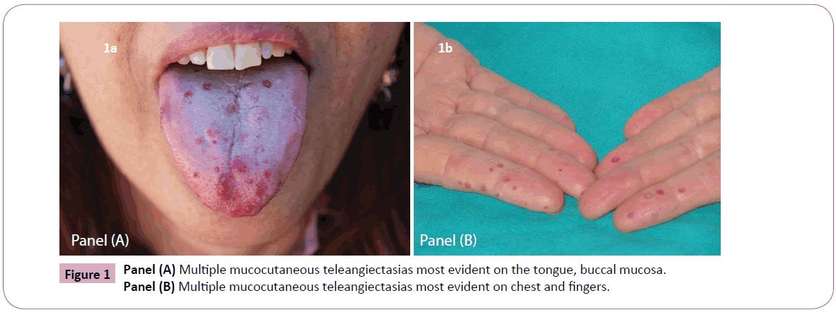 annals-clinical-laboratory-mucocutaneous